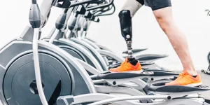 Person with a prosthetic leg using a treadmill in a gym, with multiple elliptical machines lined up in the background.