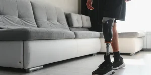 Person with a prosthetic leg standing next to a light-colored sofa in a room with wooden flooring.